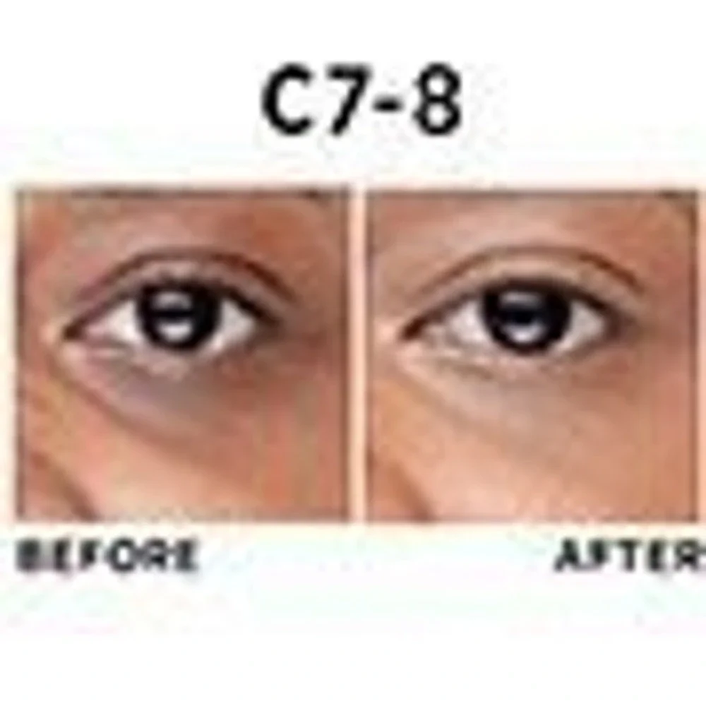 L'Oreal True Match Eye Cream‎ In A Concealer C7-8 Dark